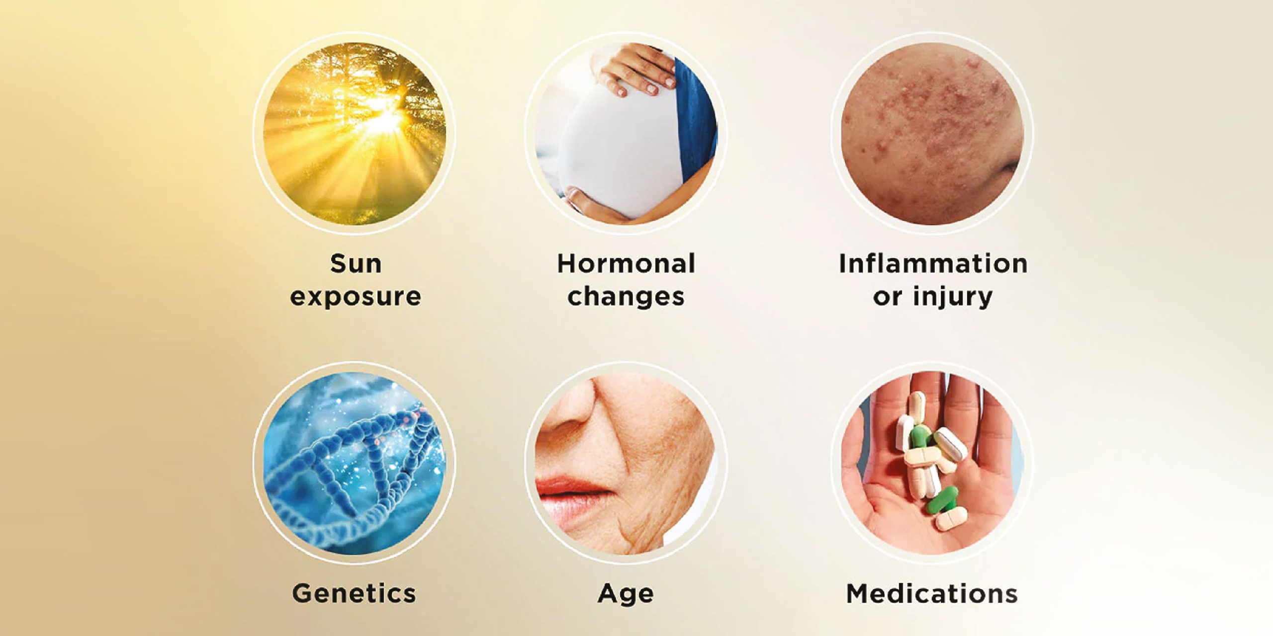 How Are Dark Spots Formed?