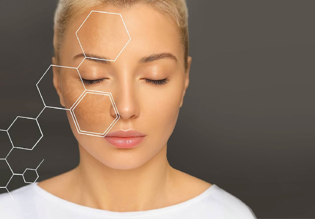 Pigmentation Problems: Top Reasons Behind Skin Hyperpigmentation